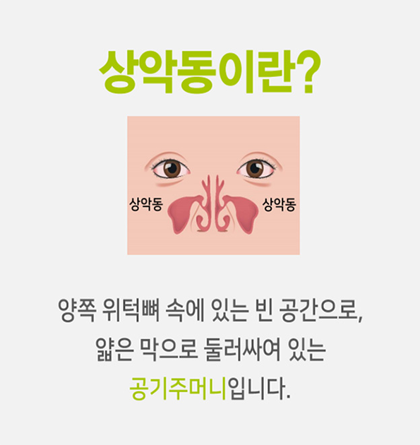 상악동 거상술